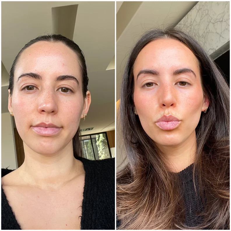 Calvonic customer sharing her results